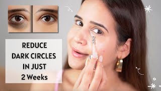 Reduce Dark Circles in just 2 Weeks  Dark Circles  Puffy Eyes  Shiv Shakti Sachdev [upl. by Thielen]