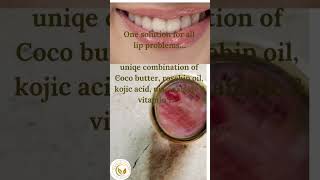 For Beautiful Lips NaturalSafe amp Effective solutions [upl. by Atalee]