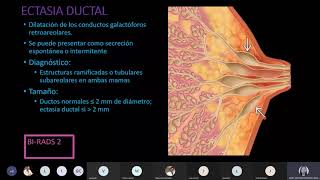 Ultrasonido de mama Evaluación de lesiones quísticas Dra Minerva Uribe [upl. by Mcdougall]