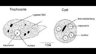 Trophozoite and Cyst of Entamoeba histolytica in LPCB mount [upl. by Iow]