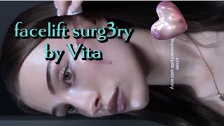 Facelift Surg3ry‼️ Rhytidectomy [upl. by Gladine]