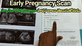 Early Pregnancy Scan  How To Read Pregnancy Scan Report  Pregnancy Scan  Pregnancy Journey [upl. by Westlund]