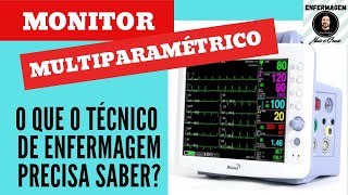 MONITOR MULTIPARAMÉTRICO  O que o técnico precisa saber [upl. by Perren]