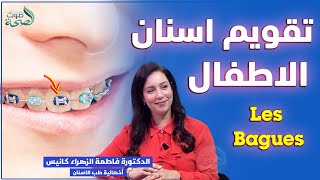 تقويم أسنان الاطفال Les Bagues  الدكتورة فاطمة الزهراء كانيس اختصاصية طب الأسنان [upl. by Schreib]