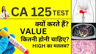 Does elevated CA 125 always mean ovarian cancer  Oncopower [upl. by Ttesil]