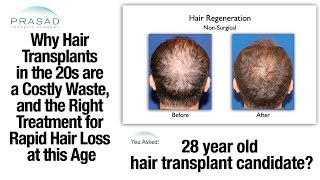 Why Hair Transplants Dont Work in the 20s and Treatment to Manage Hair Loss at This Age [upl. by Naginarb]