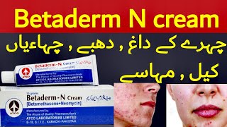 betaderm cream  betaderm n cream  betaderm n cream uses in urdu  betaderm n cream betaderm cream [upl. by Suzzy]