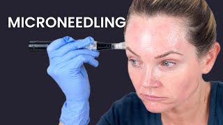 Microneedling NECK and CHEST with Dr Pen M8S Tightening my old skin at home [upl. by Lissak]