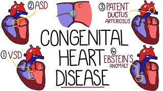 Congenital Heart Malformations Made Easy 8 Main Types [upl. by Wiatt]