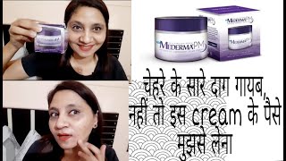 Mederma PM Cream Review  Mederma Cream  Mederma for Scars  Remove your Scars  Womens World [upl. by Ardolino]