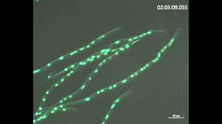 Nuclear distribution in filamentous fungi [upl. by Sutherland166]