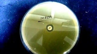 MRSA detection [upl. by Lalage252]