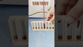 Esr westergren method  ESR test means  What does ESR lab test showlaboratory test bloodtest [upl. by Oni453]