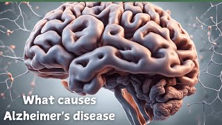 quotUnderstanding Alzheimer’s Causes Risks and Hope for a Cure [upl. by Ahtibat671]