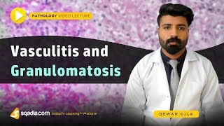 Vasculitis and Granulomatosis  Pathology Medical School  Education Made Easy  VLearning [upl. by Ecaidnac]