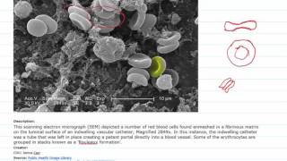 Lecture 16 Part 4 Blood rheology [upl. by Ashford]