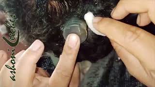 Easy way of leech therapy  khun chusane wali jonk se ho rahi hai balo ka ilaj  jok treatment [upl. by Missak]