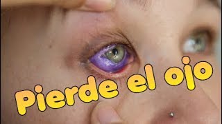 Tatuaje en el Ojo que salió muy mal Modelo pierde la vision de su ojo  Eyeball Tattoo [upl. by Haleelahk917]