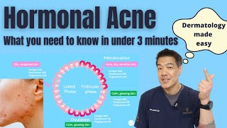 Hormonal acne explained in under 3 minutes  Dermatologist reviews [upl. by Herzberg]