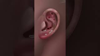 ASMR getting parasites out of a ear [upl. by Namus]