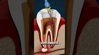 DENTE INFLAMADO😰 curiosidades impressionante curiosidade [upl. by Calandra]