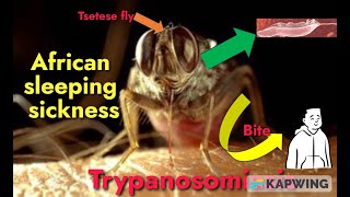 Trypanosomiasis I African sleeping sickness I Trypanosoma brucei gambiense amp rhodesiense I [upl. by Neilson]