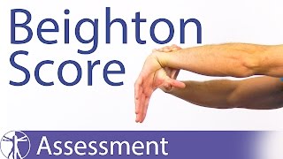 The Beighton Score  Generalized Joint Hypermobility Laxity [upl. by Anitsirc]