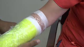 How to Shower with a Cast or Splint [upl. by Wu]