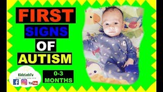 Infant First Signs OF AutisM 03 Months [upl. by Denna435]