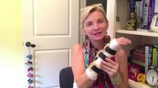 BASAL JOINT ARTHRITIS  CMC SURGERY 5 WEEKS OUT REMOVABLE BRACE [upl. by Eenel]