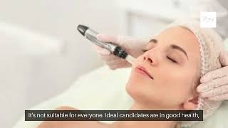 Top Benefits of RF Microneedling littleelm prospertexas Secret to Flawless Skin [upl. by Latrell]