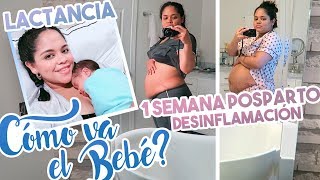 1 SEMANA POSTPARTO después de CESÁREA 👶 INFLAMACIÓN 🍼 LACTANCIA  ADAPTACIÓN [upl. by Katheryn]