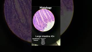 ANATOMY  HISTOLOGY  LARGE INTESTINES  IDENTIFICATION FEATURES mbbs anatomy life histology [upl. by Niatsirt]