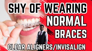 Teeth straightening without bracesClear Aligners for teethInvisalign Braces [upl. by Accebber77]