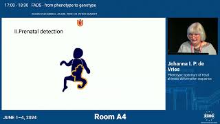 E081  Phenotypic spectrum of Fetal akinesia deformation sequence [upl. by Gnuoy]