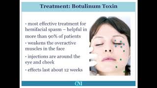 What is Hemifacial Spasm [upl. by Auoh]