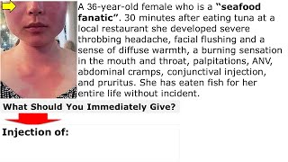 Reaction after eating fish What is your treatment Q CME internalmedicine محاضراتباطنة [upl. by Assille]