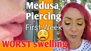 Philtrum Medusa Piercing  Swelling  Healing Process  First Week [upl. by Mccourt]