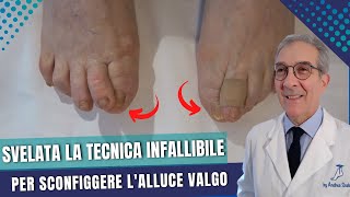 Alluce valgo diagnosi e intervento  Svelata la Tecnica Infallibile per Eliminare lAlluce Valgo [upl. by Jocelin176]