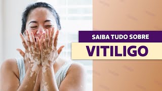 Vitiligo tem cura Saiba os sintomas causas e tratamentos  Viver Bem [upl. by Peadar467]