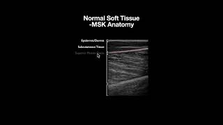 Normal Sonoanatomy of the Musculoskeletal Layers [upl. by Yelknirb]