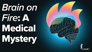 Brain on Fire A Medical Mystery [upl. by Jerry]