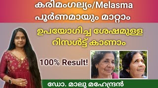 കരിമംഗല്യം ഇനിയൊരു പ്രശ്നമല്ല Herbal Anti Melasma Face pack  Mukhavarnya Tailam melasmatreatment [upl. by Rickard]