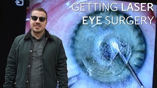 Laser eye surgery Heres what its like to have the procedure [upl. by Assirac]