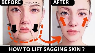 🛑 ANTIAGING FACE LIFTING EXERCISES FOR SAGGING SKIN and JOWLS  LAUGH LINES FOREHEAD  SUBTITLES [upl. by Ibot65]