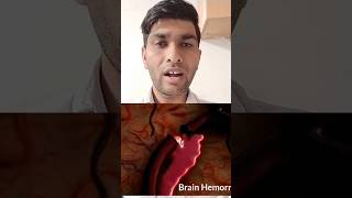 Brain Hemorrhage Kaise Hota Hai brainhemorrhage braindisease braindamage [upl. by Brian444]