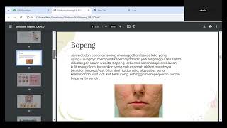 video webinar ttng skinbooster 13 november 2024 [upl. by Ettedanreb]