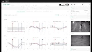 Impairment Focused Interpretation with Qualisys Gait Reports  Webinar [upl. by Anaiv]