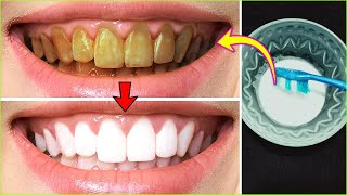 Whitening yellow teeth in just 3 minutes hydrogen peroxide with baking soda [upl. by Nemad]