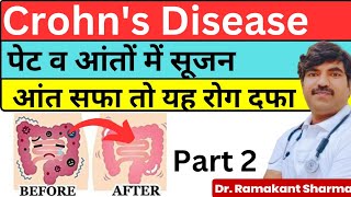 Crohns Disease Treatment  आंतो में सूजन  Inflammatory Bowel Disease Explaineddrramakantsharma7 [upl. by Nikolas]